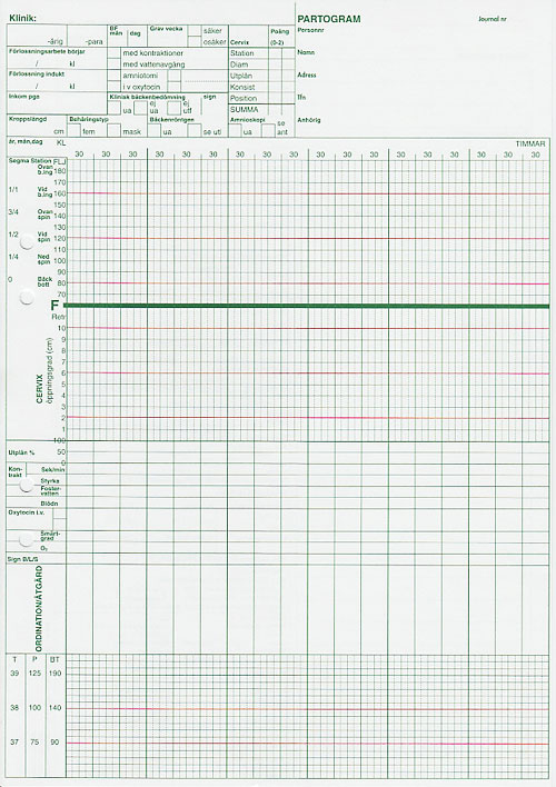 Bok: Partogram